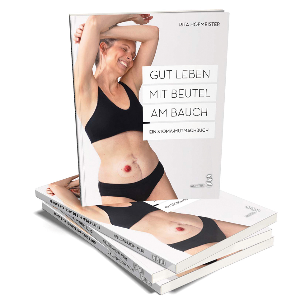 „Gut leben mit Beutel am Bauch. Ein Stoma-Mutmachbuch“